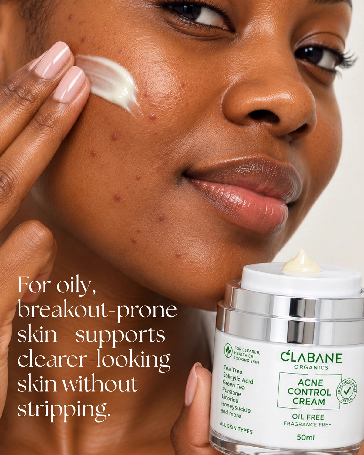 Clabane Organics Acne Control Cream